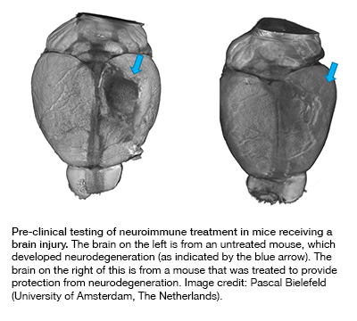 A comparison of two brains from mice following brain injury with and without treatment.