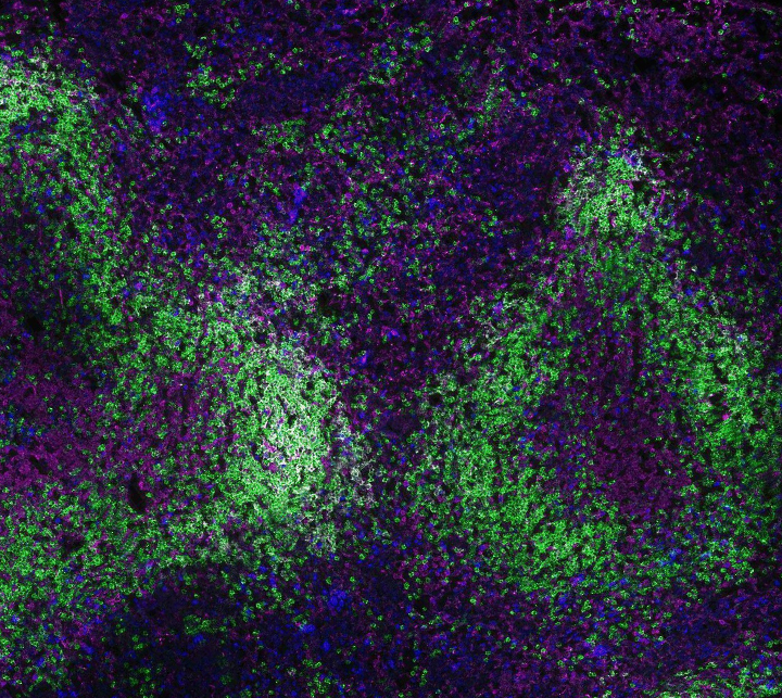 Immune cells in a mouse spleen from an aged mouse