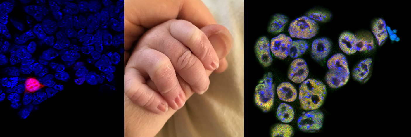 A tale of two Melanies: mitigating the impact of lab long term leave