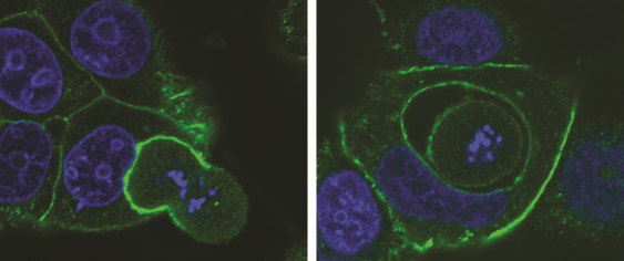 Two images of dividing cells being cannibalised other cells   