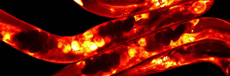 A brain switch that helps worms keep their cool
