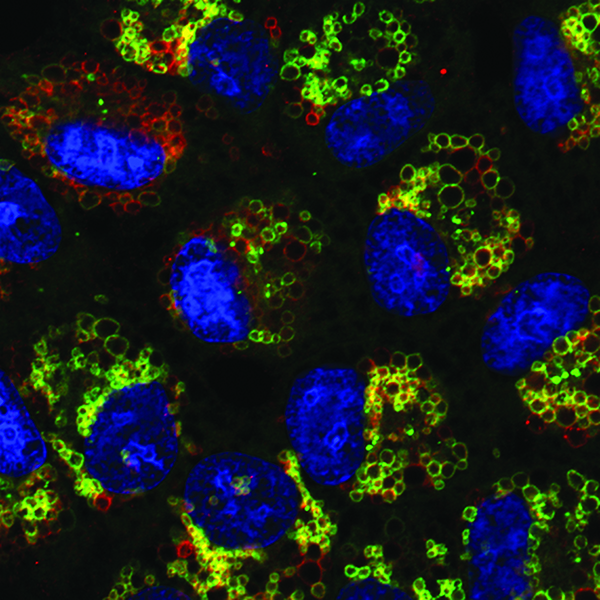 Vesicle section