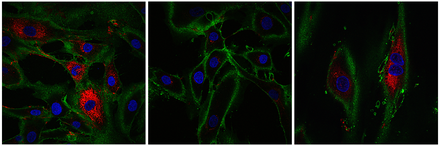 Rejuvenating skin cells (right) showing collagen production compared to young cells (left) and old cells (middle)