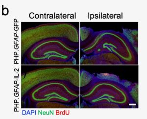 Immunofluorescence staining of two mouse brains