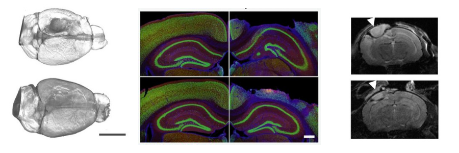 Harnessing the immune system to treat traumatic brain injury