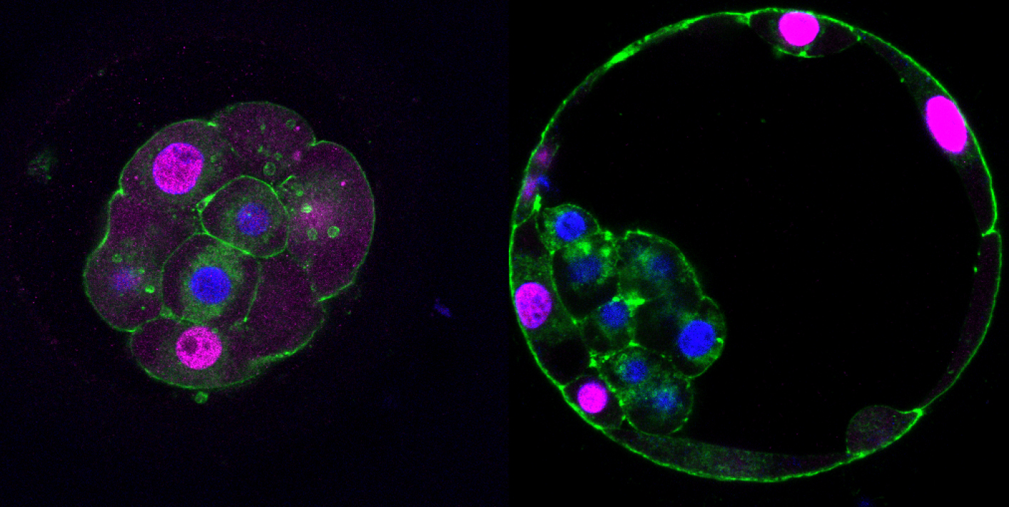 Trophoblast