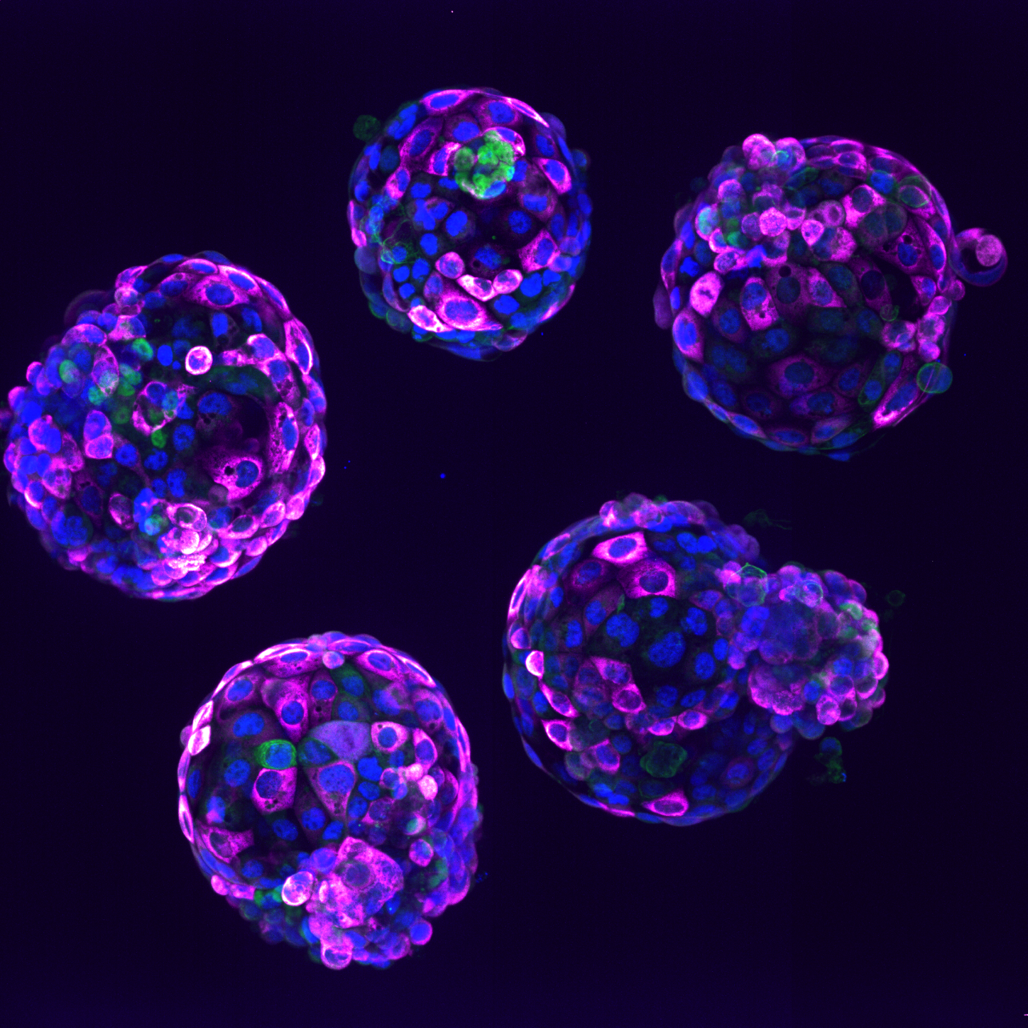 Human embryo-like structures derived from human embryonic stem cells (blastoid) that form balls of cells with an inside cavity that look very much like blackberries. 