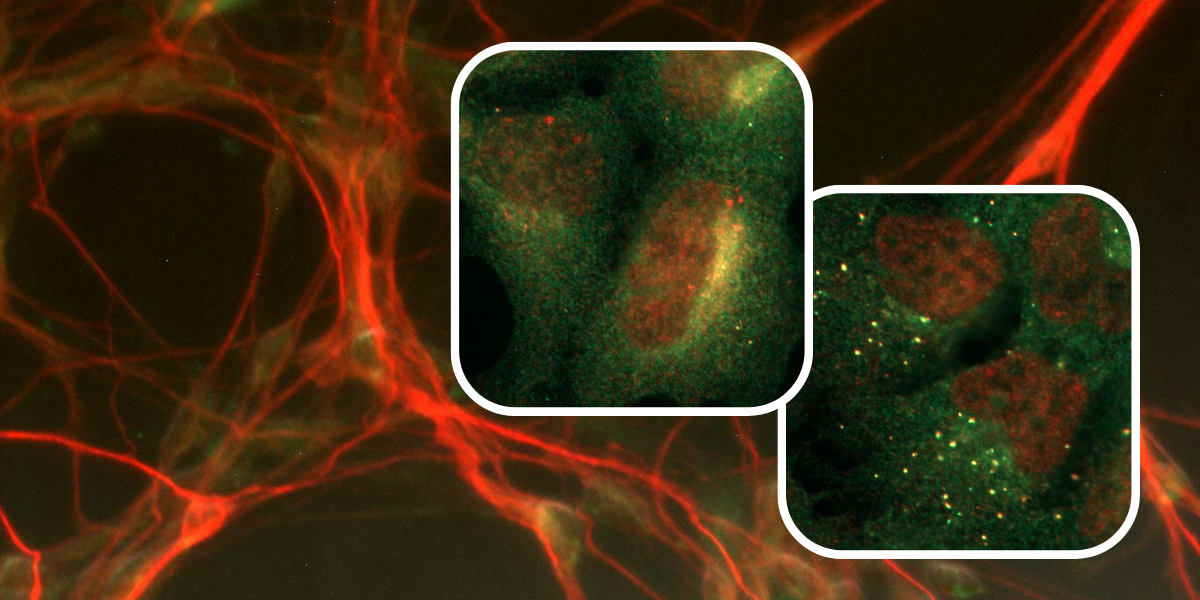 Stemnovate and Babraham Institute come together to untangle the tauopathy in Alzheimer’s disease