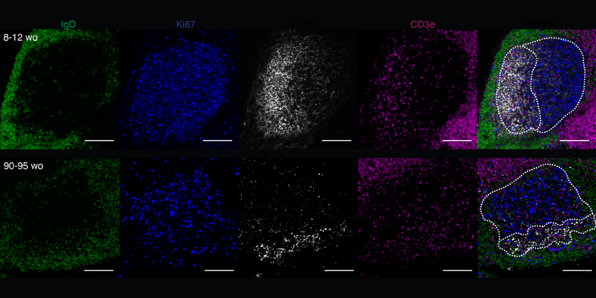 &#039;Lost&#039; immune cells partly to blame for reduced vaccine response in older people