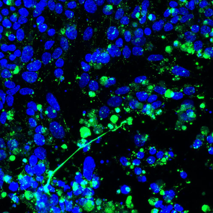 A mix of vivid blue and green circular shapes on a black background. Green labelling shows extracellular histone proteins and blue labelling shows DNA. 