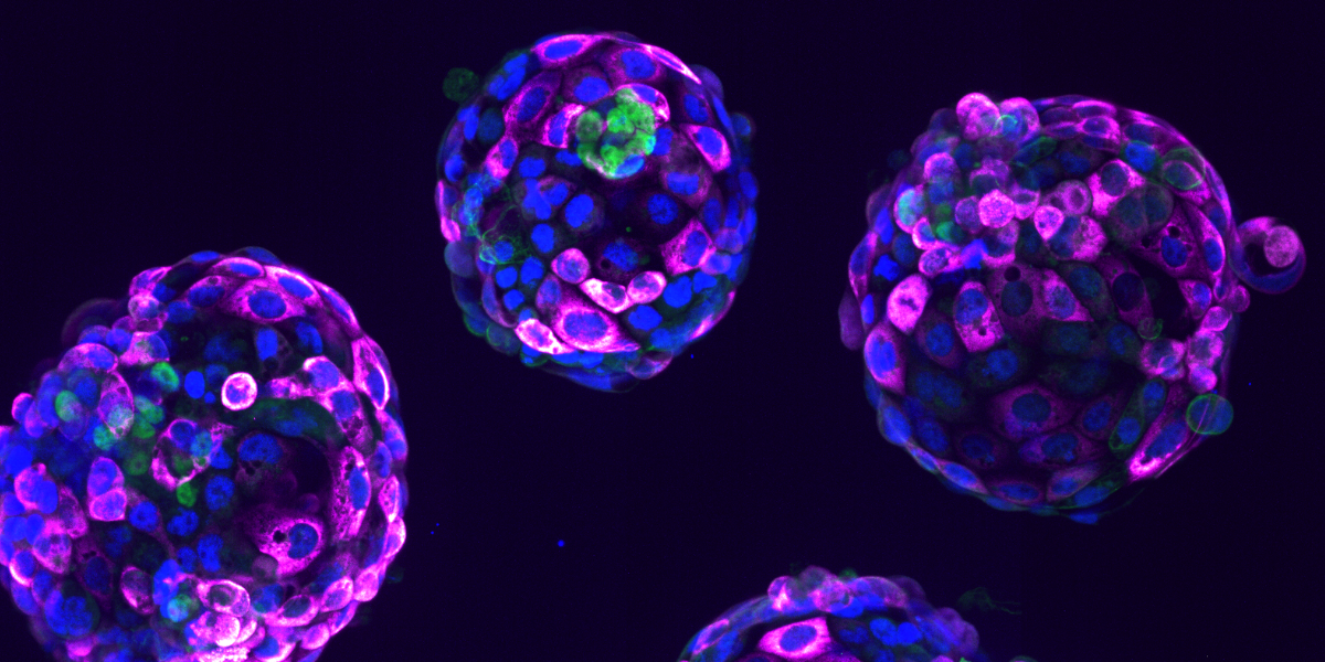 Image used on the cover of the 2021-2022 review showing three spherical embryo-like balls of cells (blastoids) in blue and pink. Blue marks all nuclei of the structure, the green label marks the cells that will generate the embryo proper (Nanog), and the pink label is a readout of a ribosomal protein (pS6). 