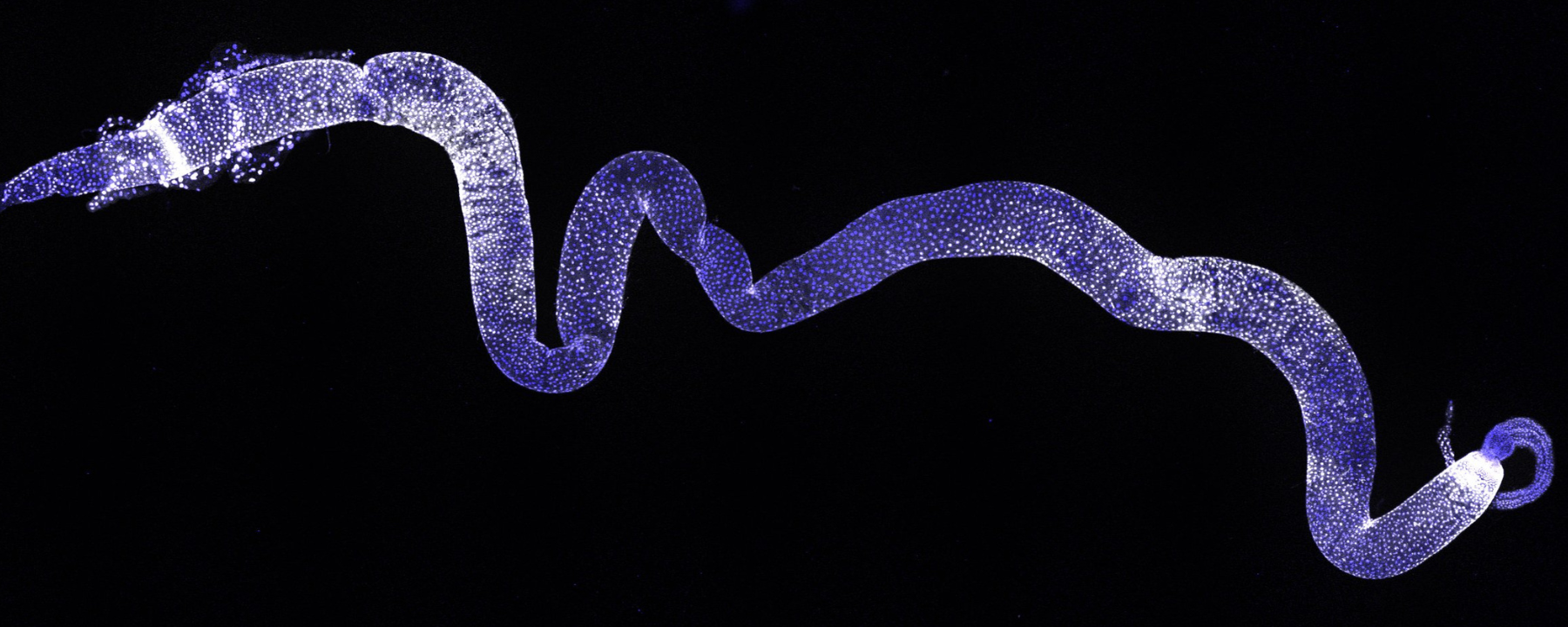 An image of the Drosophila gut, the structure that is equivalent to the human small intestine. Blue fluorescence marks cell nuclei and white fluorescence shows the location of a phosphorylated protein involved in the signalling pathway that establishes a molecular gradient to maintain tissue patterning and homeostasis.