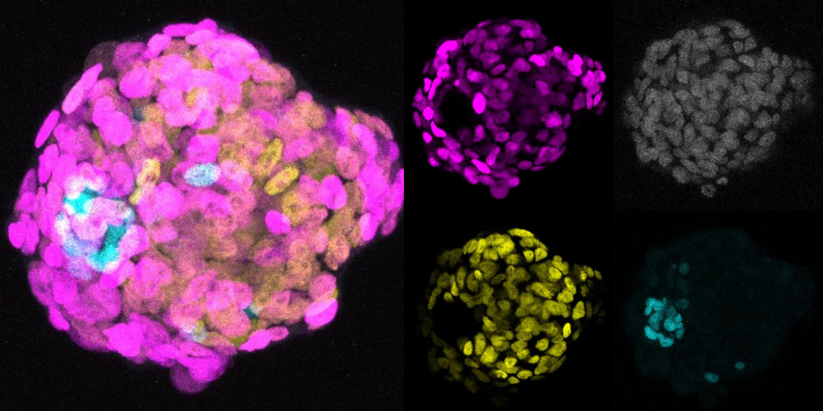 Degree of cell crowding in the early human embryo influences cell identity decision, new culture system finds