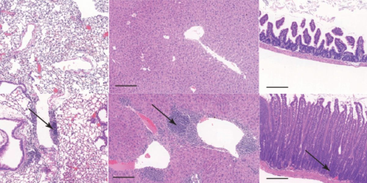 Maintaining balance in the immune system