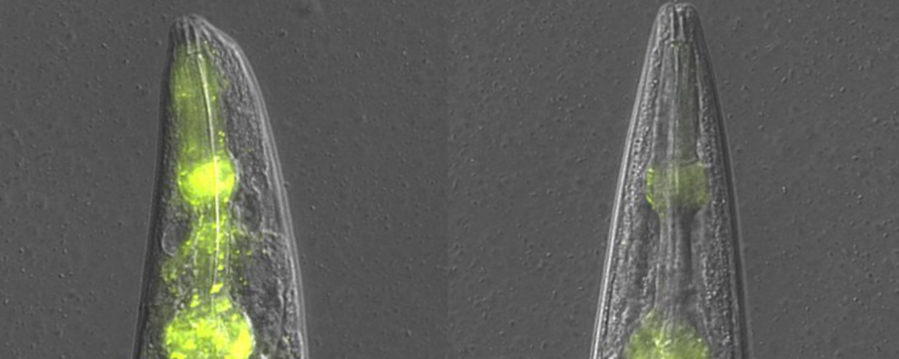 Comparison of two C. elegans worms with cellular staining