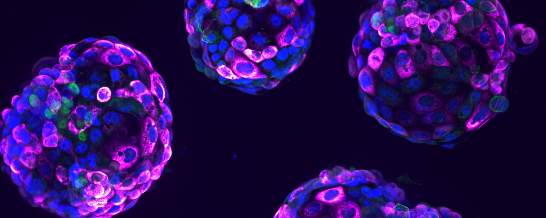 Balls of cells (blastoids) derived from human embryonic stem cells