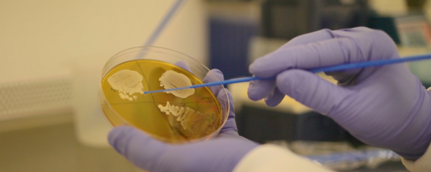 Yeast being picked off an agar plate