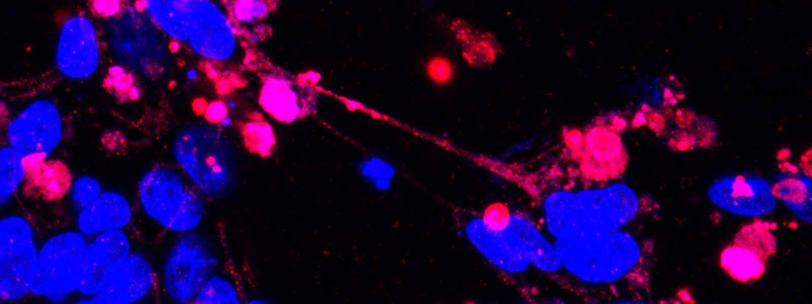 Extracellular histones marked by citrullination (red) and DNA in blue.