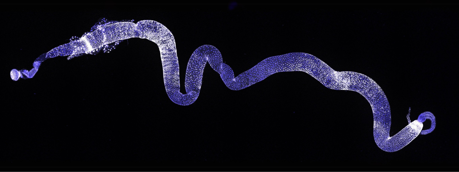  A microscopy image of a Drosophila gut. Blue indicates cell nuclei, white shows the presence of a phosphorylated protein involved in establishing and maintaining tissue patterning.