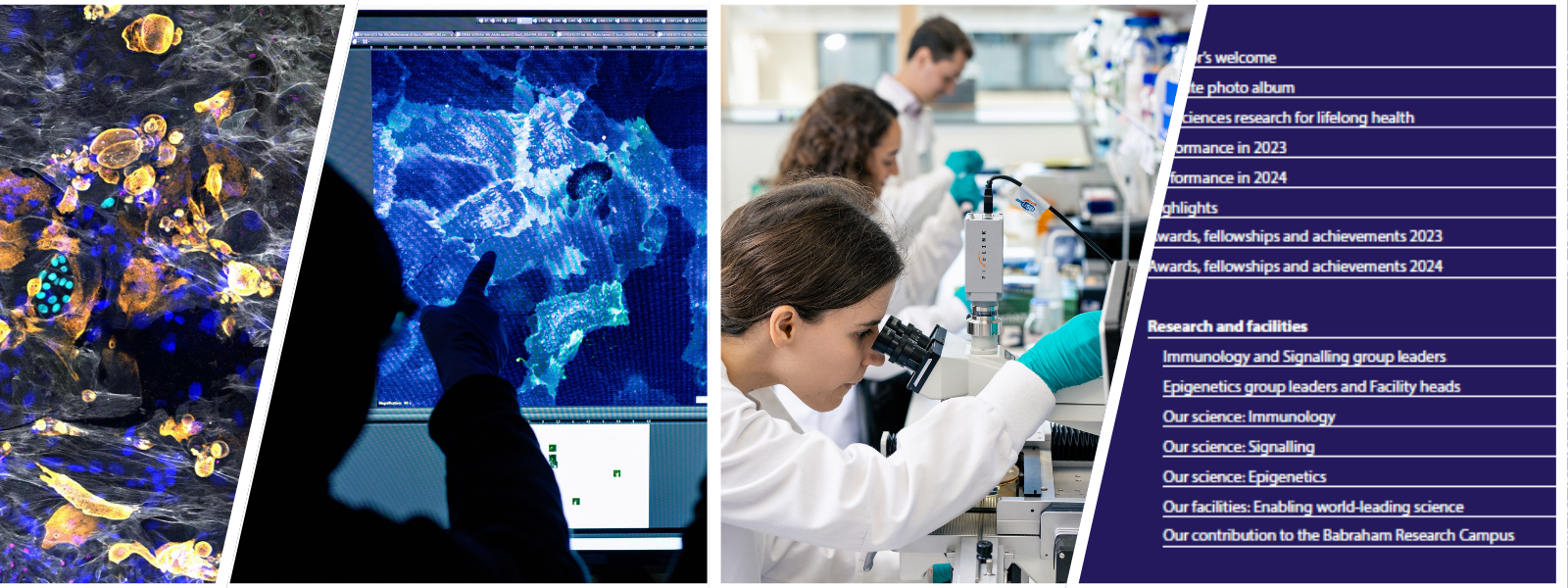 Four images taken from the report visuals: cover image, researcher looking at some microscopy on a computer screen, researchers working in the lab and a clip of the report content's page.