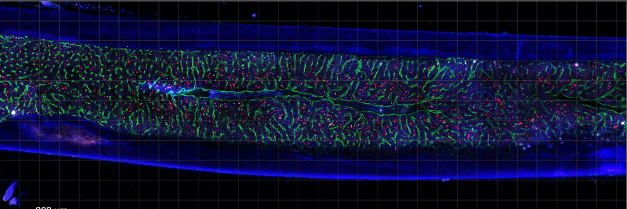 Fluoresent image of mouse bone marrow, a source of antibody-producing plasma cells. 
