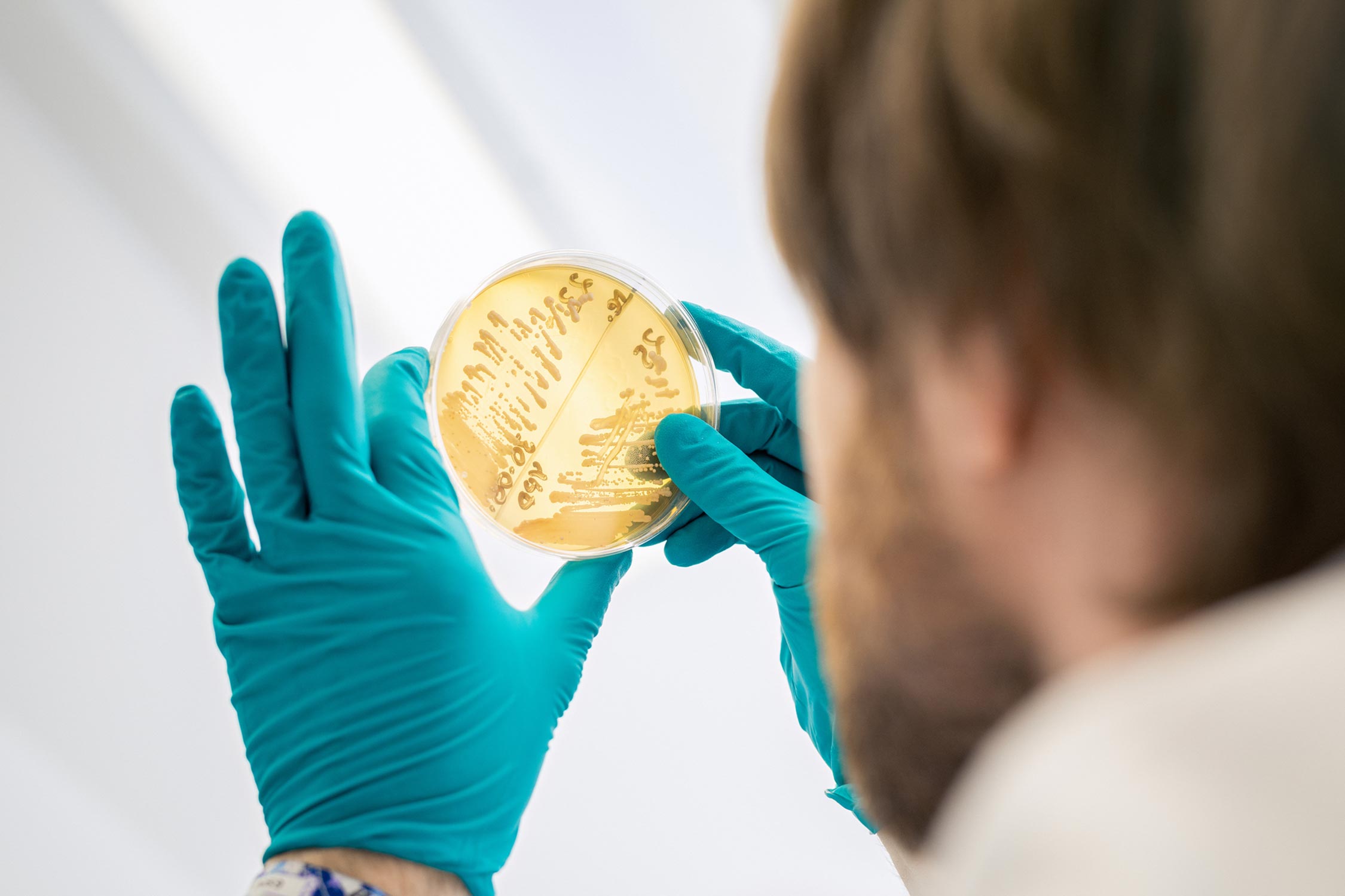 Researcher looking at yeast on an agar plate
