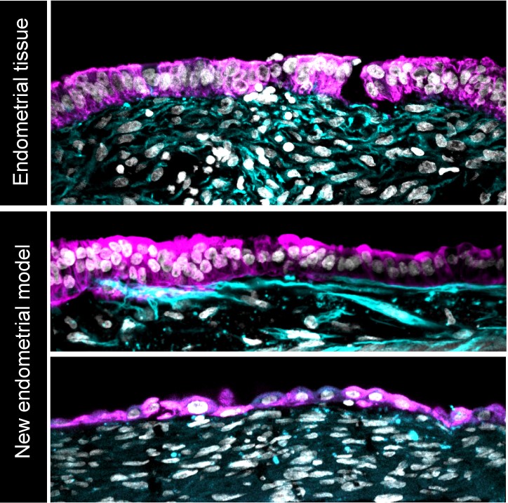 Side view showing the similarity of the new endometrial model 