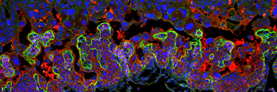 Hemberger group image is Biomedical Picture of the Day