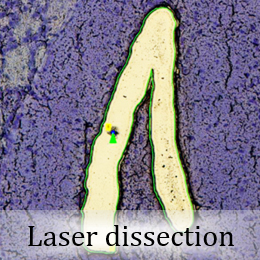 Cell image via laser micro-dissection