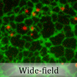 Cell image via wide-field imaging