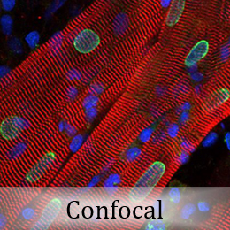 Cell image via confocal microsopy