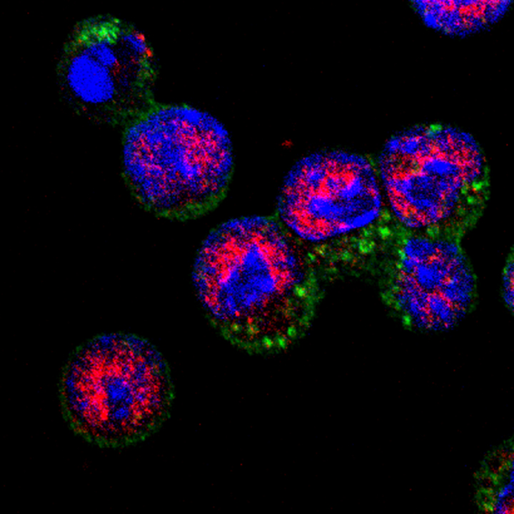 Faulty genome decoding knocks down B cell ability to produce antibodies