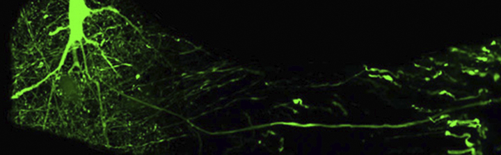 Coleman nerve image