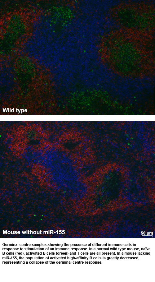 Germinal centre samples showing the presence of different immune cells in response to stimulation of an immune response.