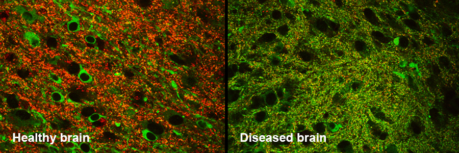 Brain in a dish to learn more about Alzheimer’s disease