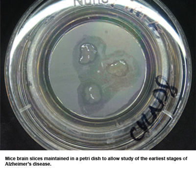 Brain slices from mice, maintained in culture to allow the study of the earliest stages of Alzheimer's disease