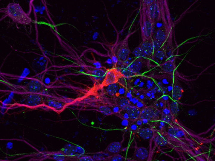 Cell culture