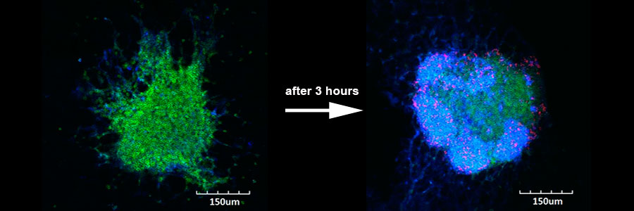 Fat tissue clusters act as hubs for local immune responses