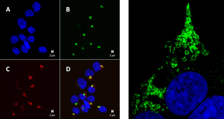 GMAP1 expression