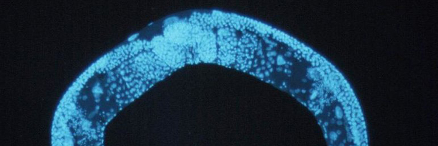 EU LIFE Lecture - Histone Chaperones Maintain Cell Fates and Antagonize Reprogramming in C. elegans