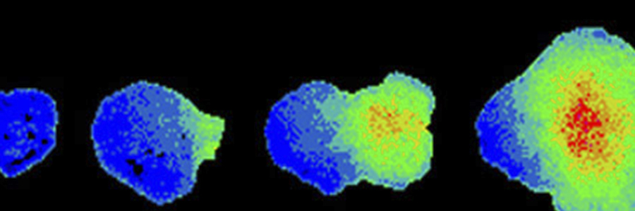 Babraham scientists reveal how white blood cells get activated in auto-immune disease