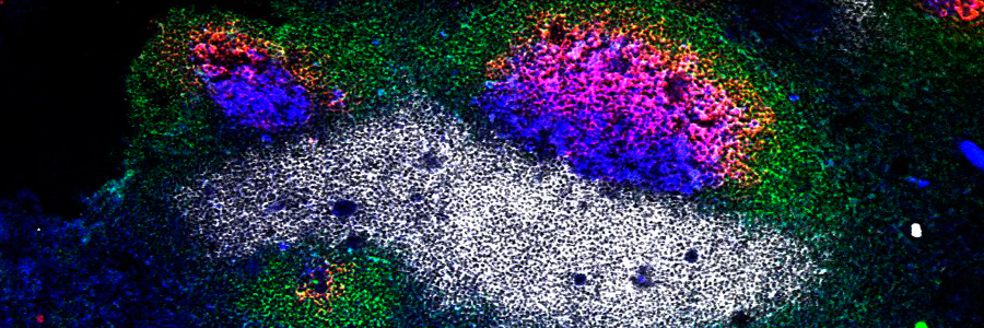 A testing time: understanding more about how the ‘best’ B cells are selected