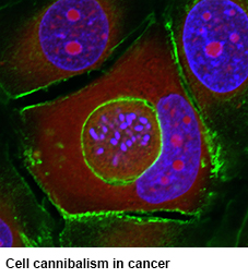 Microscopic image showing cell cannibilism