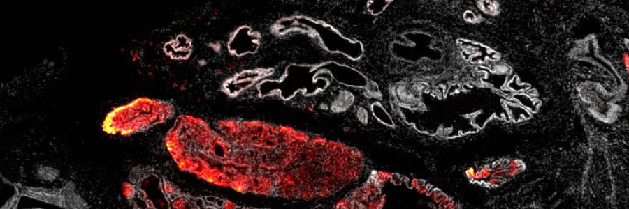 New fundamental biology may aid cancer treatments