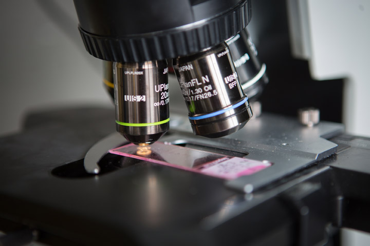Fluorescence imaging: seeing the light