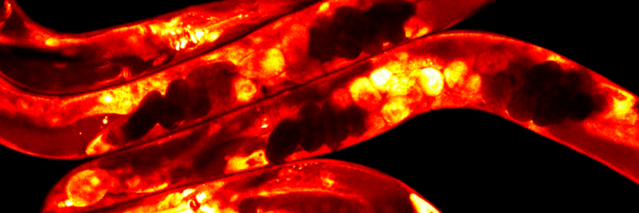 C. elegans worms labelled with a fluorescent protein and imaged using a confocal microscope