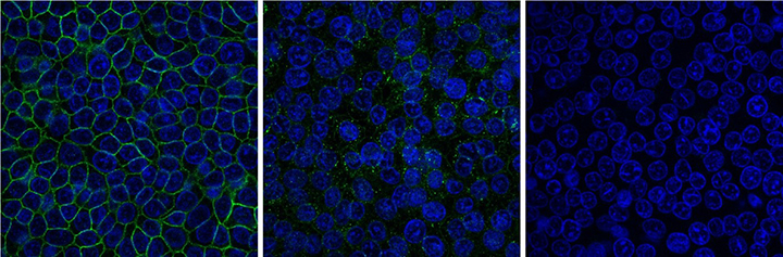 Oncoproteins