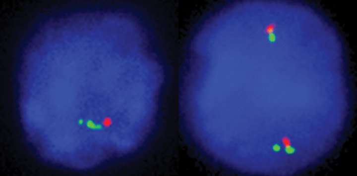 RNA-Fish