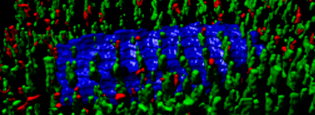 Babraham researchers reveal how heart muscle cells get remodelled in response to disease and ageing