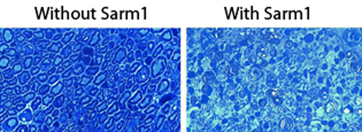 Babraham-US collaboration reveals how injured nerves initiate self-destruction